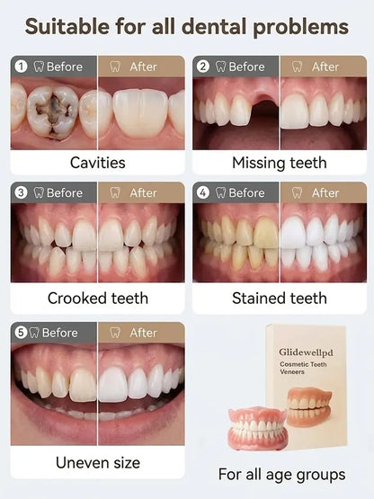 Premium Full Cover Dentures