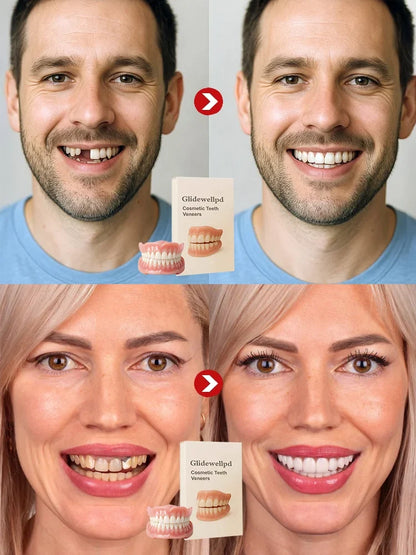Premium Full Cover Dentures